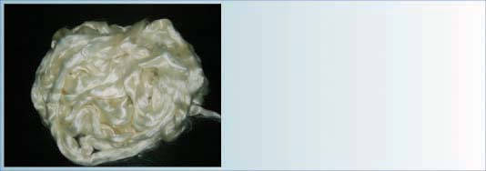 Tops of milk protein fibers